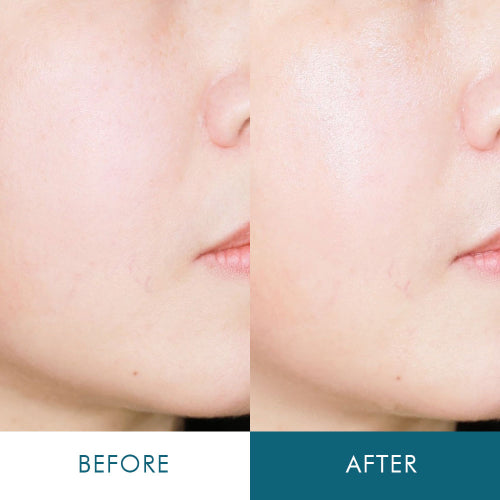 LITHEMIS Ceramide peptide hyaluronic acid quick drying regenerating ampoule cream for extremely dry skin (2 types)