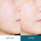 LITHEMIS Ceramide peptide hyaluronic acid quick drying regenerating ampoule cream for extremely dry skin (2 types)