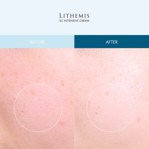 LITHEMIS Ceramide peptide hyaluronic acid quick drying regenerating ampoule cream for extremely dry skin (2 types)