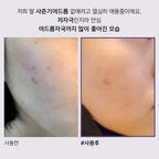 ACLEON ACLEON Anasys Acleon Acne Trouble Spot 30ml