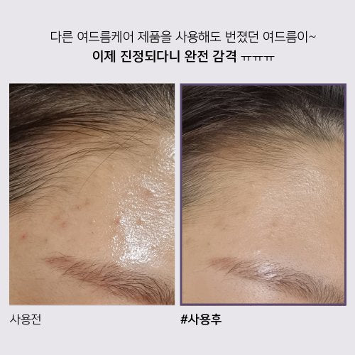 ACLEON ACLEON Anasys Acleon Acne Trouble Spot 30ml