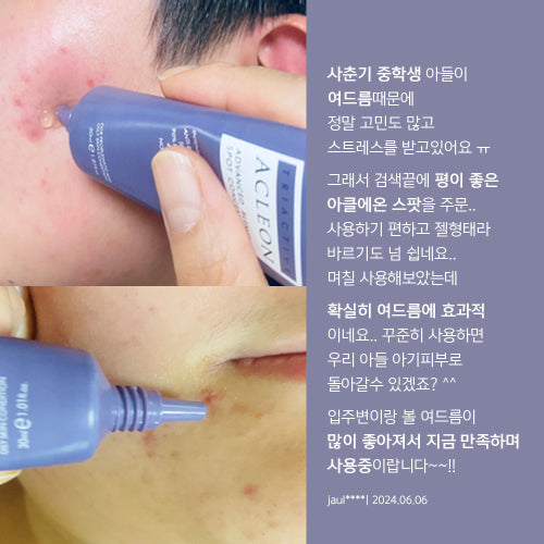 ACLEON ACLEON Anasys Acleon Acne Trouble Spot 30ml