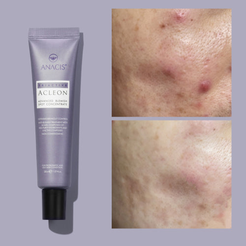ACLEON ACLEON Ampoule Trouble Spot