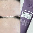 ACLEON ACLEON Ampoule Trouble Spot