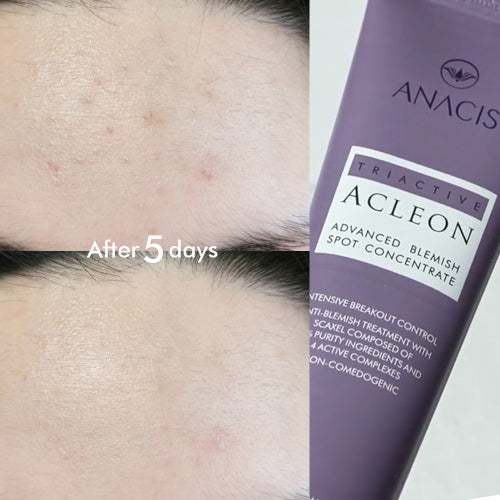 ACLEON ACLEON Ampoule Trouble Spot