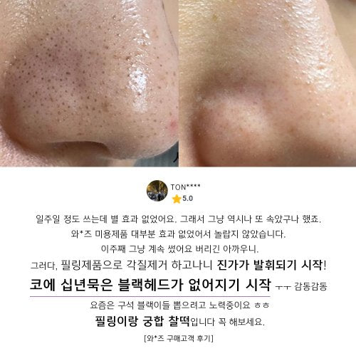 ACLEON ACLEON Blackhead Sebum Softener Cleanser Set