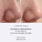ACLEON ACLEON Blackhead Sebum Softener Cleanser Set