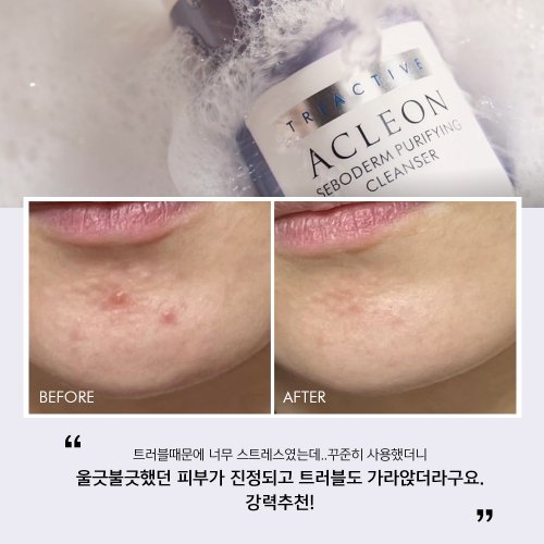 ACLEON ACLEON Cleansing Foam Mild Alkaline