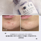 ACLEON ACLEON Cleansing Foam Mild Alkaline