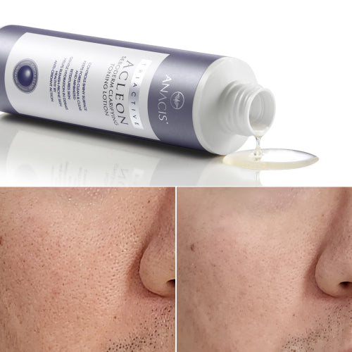 ACLEON ACLEON Cleansing Foam Mild Alkaline