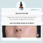 LITHEMIS LITHEMIS Anasys Re-Sink Ampoule 55ml