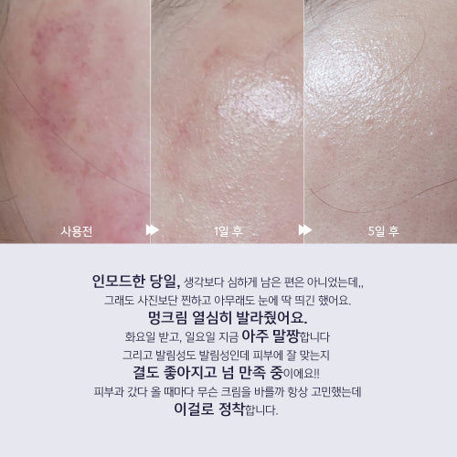 LITHEMIS K Oxiderm Vitamin K Oxide Bruise Cream 15ml