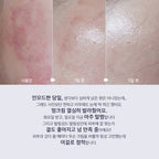 LITHEMIS K Oxiderm Vitamin K Oxide Bruise Cream 15ml