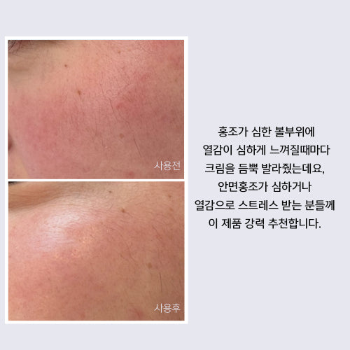 LITHEMIS K Oxiderm Vitamin K Oxide Bruise Cream 15ml