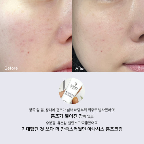 LITHEMIS K Oxiderm Vitamin K Oxide Bruise Cream 15ml