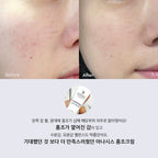 LITHEMIS K Oxiderm Vitamin K Oxide Bruise Cream 15ml