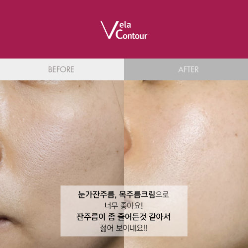 VELACONTOUR Anasys Wrinkle Improvement Facial Neck Wrinkles Nasolabial Wrinkles Lifting Firming Cream 30ml