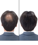SUPER MILLION HAIR 1 black cabbage 25g + 165ml dedicated mist