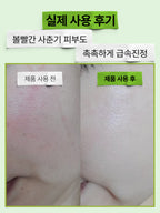 EFILOW [2 pack] Artichoke Hyalusica Moisturizing and Soothing Ampoule 50ml