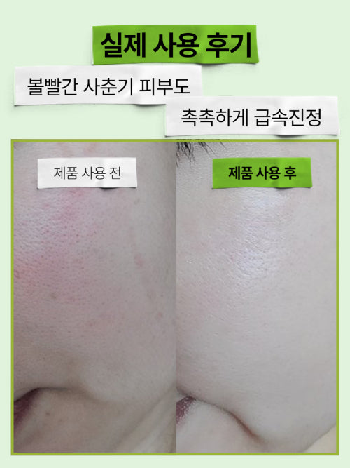 EFILOW [2 pack] Artichoke Hyalusica Moisturizing and Soothing Ampoule 50ml