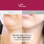 VELACONTOUR Neck wrinkles, jawline, deep cheek elasticity lifting ampoule 30ml, 13 types clinical trials completed