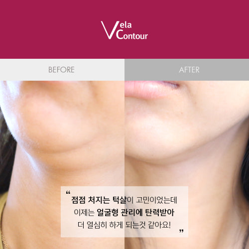 VELACONTOUR Neck wrinkles, jawline, deep cheek elasticity lifting ampoule 30ml, 13 types clinical trials completed