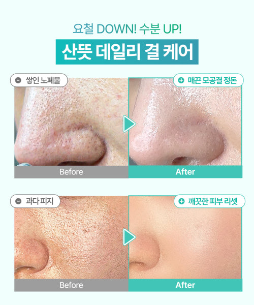 OMITTED Fresh Lime LHA Glowing Pore Toner Pad 70 sheets