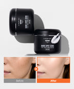 MQNY [2 items] Dark Spot Zero PDRN Radiance Cream 100g/ Blemish Radiance PDRN Melasma Cream/ 114.53% improvement in dark spot pigmentation Clinical trial