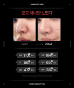GEAR BY GASH [Intensive pore care] Targeted™ Pore Toner _ Hydro Rebuild Gel™ Mist 100ml