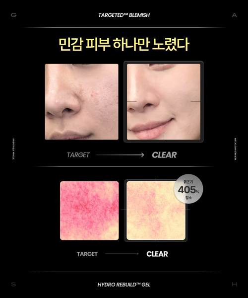 GEAR BY GASH [Intensive care for sensitive skin] Targeted™ Blemish Toner _Hydro Rebuild Gel™ Mist 100ml