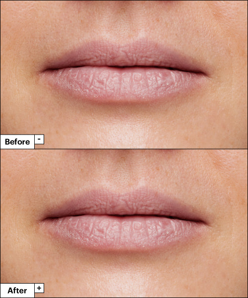 Dr.Jart+ Dr.Jart+ Vital Hydra Solution Hydrating Lip Mask 20g
