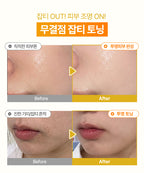 OMITTED Vita C Niacinamide 5% Bubble Shot Ampoule 90ml