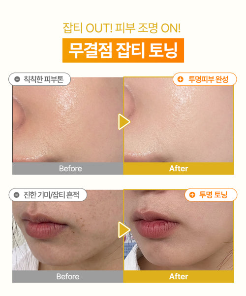 OMITTED Vita C Niacinamide 5% Bubble Shot Ampoule 90ml